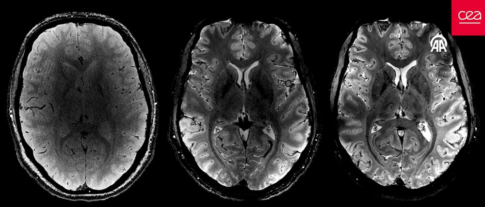 İnsan beyninin en net görüntüsü yayınlandı: Dünyanın en güçlü MRI cihazıyla çekildi - 2