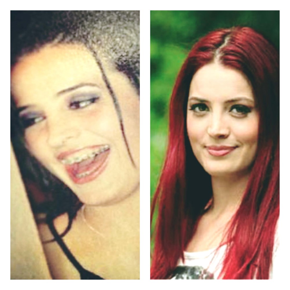 Mert Demir'in Yeni İmajı Sosyal Medyayı Salladı: Değişime Yorum Yağmuru! 282 K8a9toQmSEGp4T641IG2sw