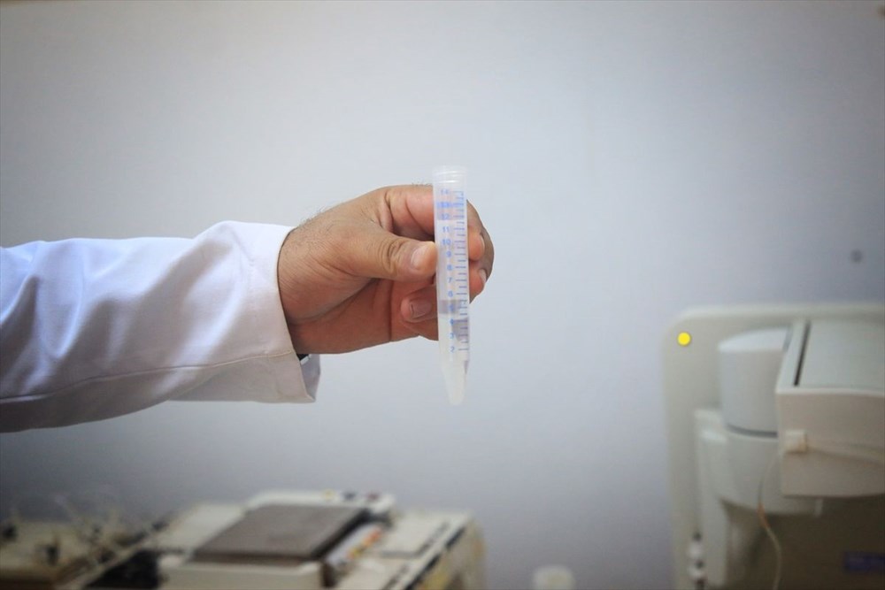 Müsilaj sağlık için tehdit mi? Bilim kurulu üyesinden açıklama - 5