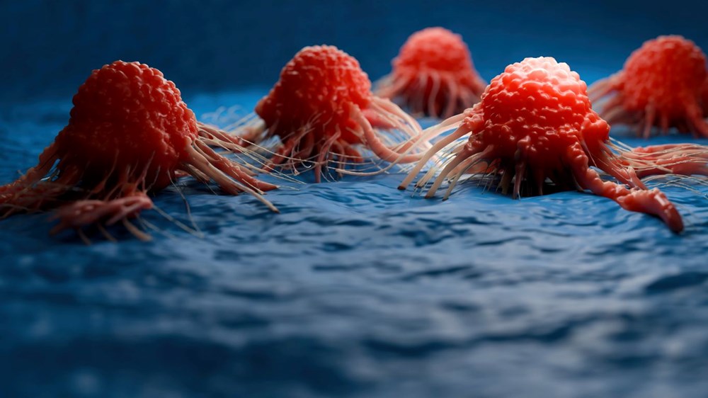 Tabipler 2 belirtiyi ciddiye almadı: 10 hafta içinde en ölümcül kanserden öldü 75 KIs XY4gBkuaZI1G zQKtA