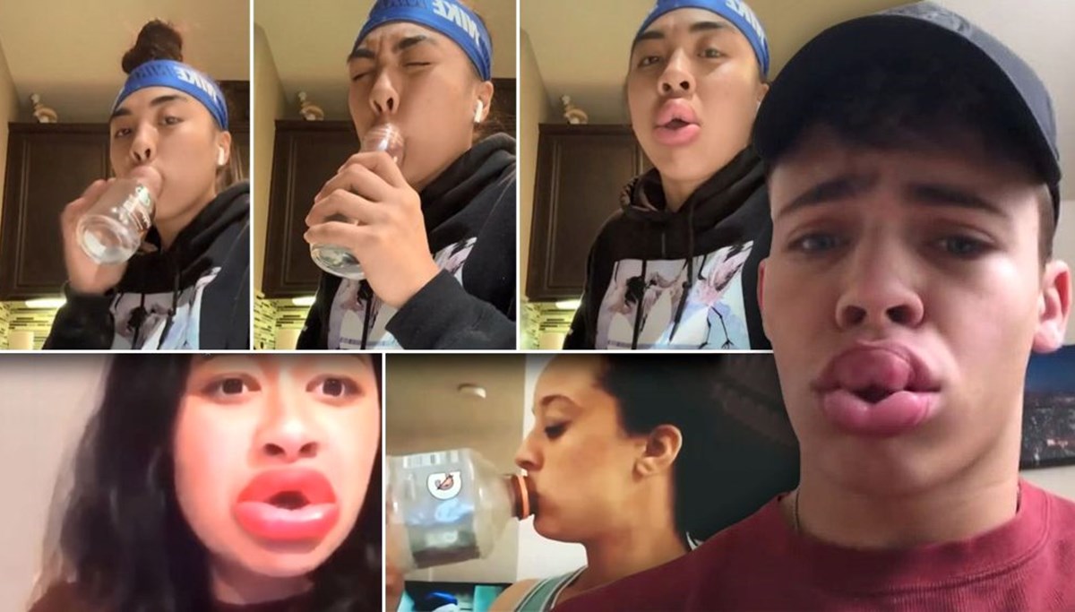 Gençlerin tehlikeli 'evde estetik' akımı