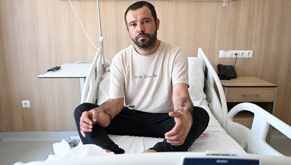 Elektrik akımına kapıldı, 7 büyük ameliyat geçirdi: 
