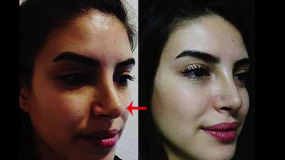 Nilsu Berfin Aktaş'tan yeni imaj (Ünlülerin değişimi) 284 KjLBvcHSXkiu5kkvrFdoTA