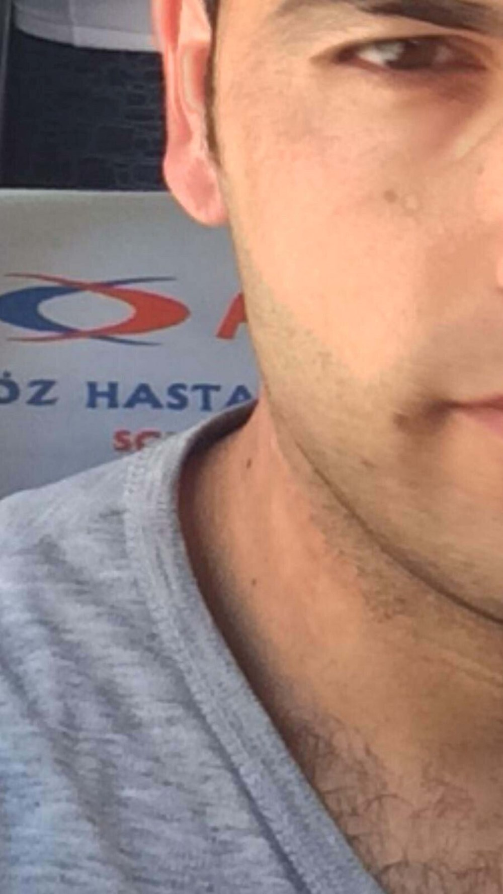 Lazer hayatını kararttı: Tedavi 30 yıl geriye götürdü - 5