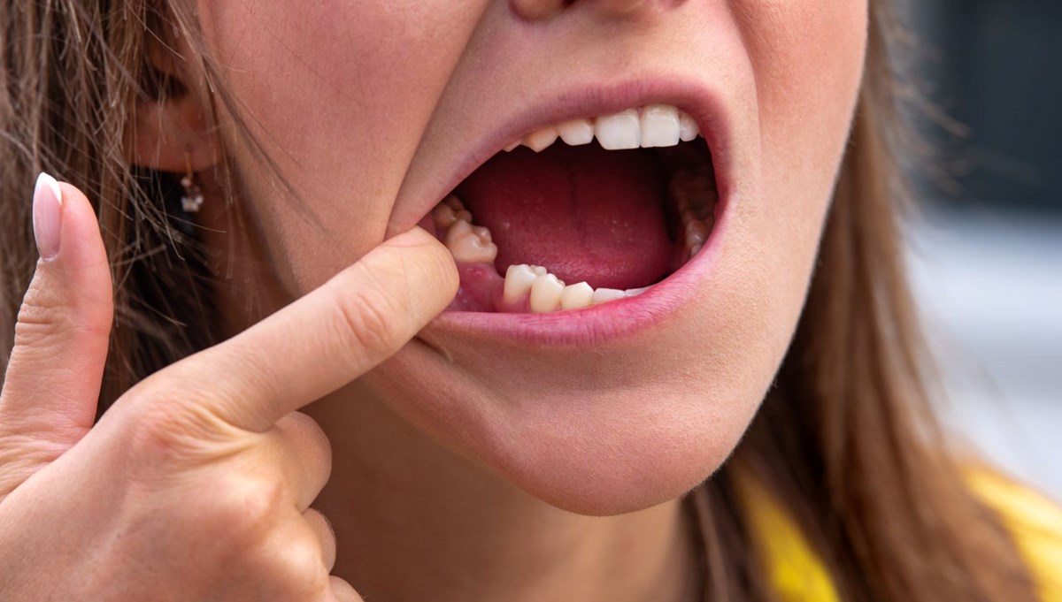 Japonya'da ilaç geliştiriliyor: Dişler yeniden çıkarılabilir