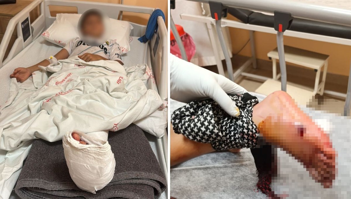 Balkonda oturan çocuğa kurşun isabet etti Balkonda oturan çocuğa kurşun isabet etti