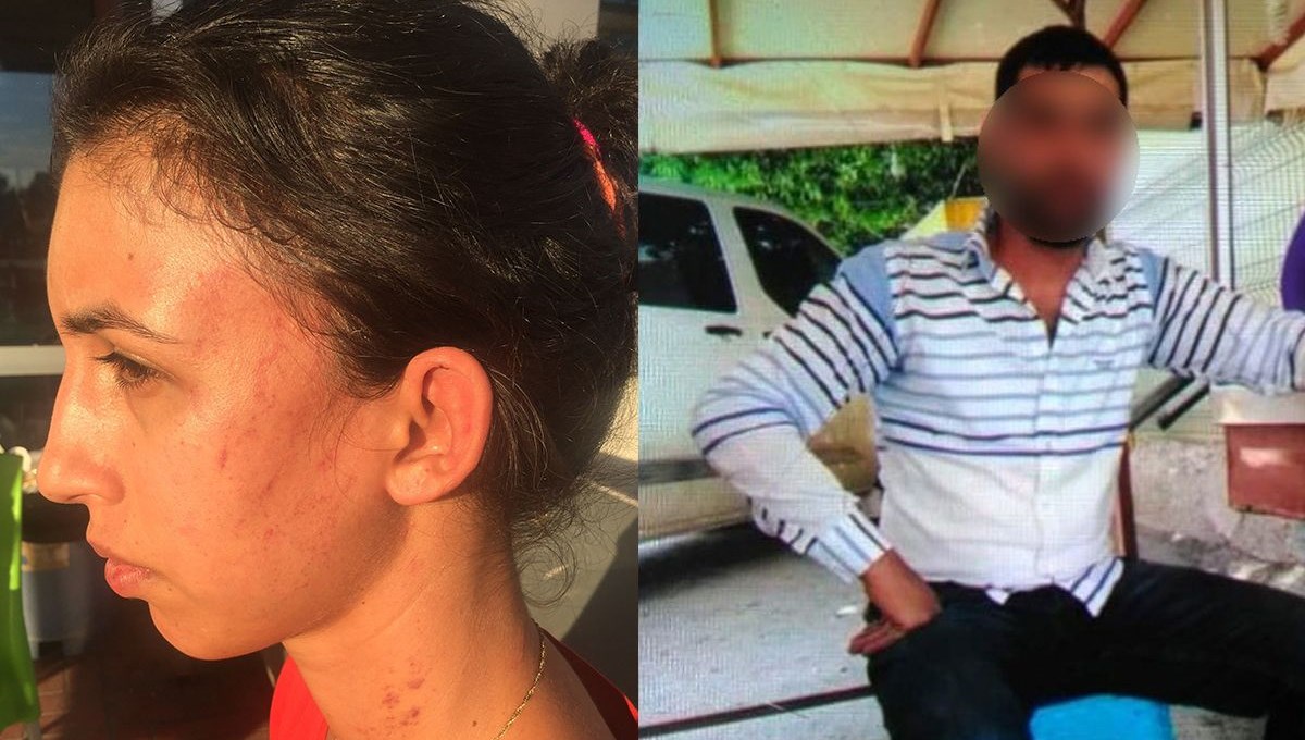 Boşanmak isteyen kadına şarj kablosu ve kalem ile işkence