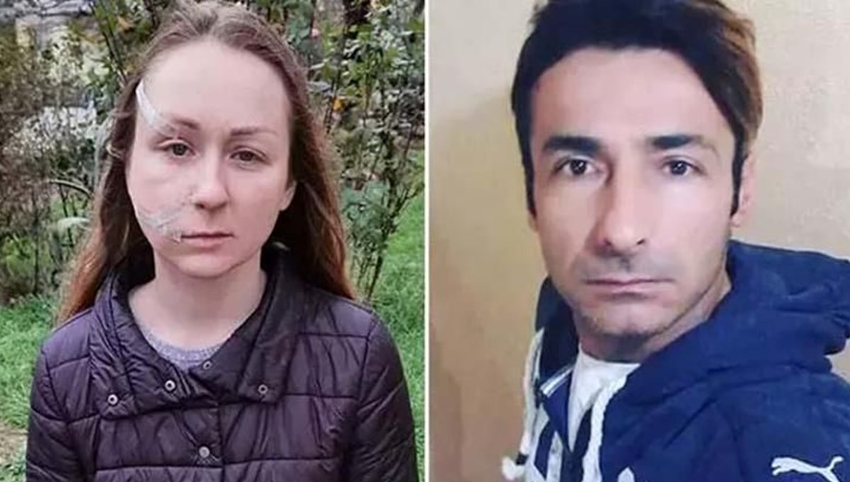 Ukraynalı eşinin yüzünü falçatayla kesen sanığa tahliye Ukraynalı eşinin yüzünü falçatayla kesen sanığa tahliye