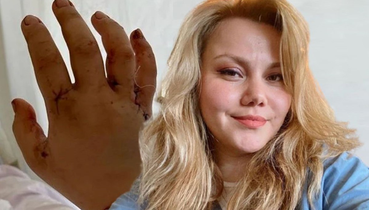 Eşi tarafından 32 kez bıçaklanan YouTuber Merve Veziroğlu yaşadıklarını anlattı: Çok yalvardım, ‘öleceksin’ dedi Eşi tarafından 32 kez bıçaklanan YouTuber Merve Veziroğlu yaşadıklarını anlattı: Çok yalvardım, ‘öleceksin’ dedi