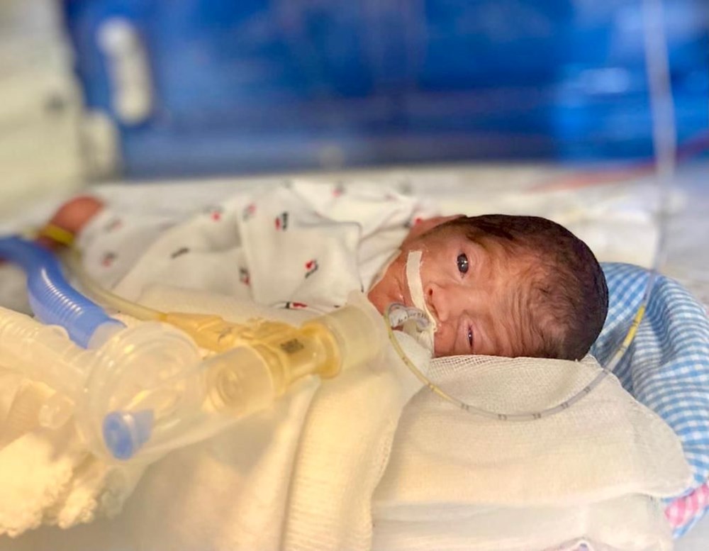 648 gram doğdu, 3 ay yoğun bakımda kaldı: Umut bebek hayata tutunmayı başardı - 7