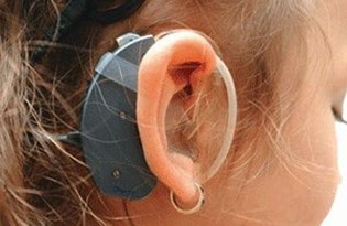 Kulak Agrisinin Altinda Yatan 8 Neden Otalji Nasil Tedavi Edilir Saglik Haberleri Ntv