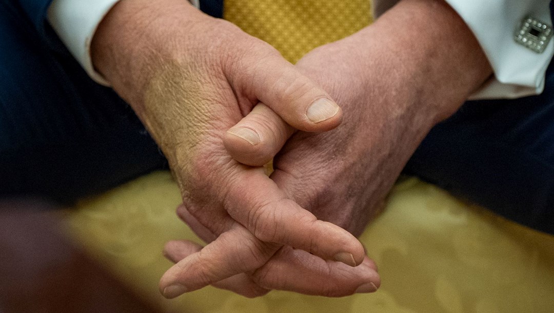 Trump'a şok teşhis: Uyması gereken üç yeni kural var