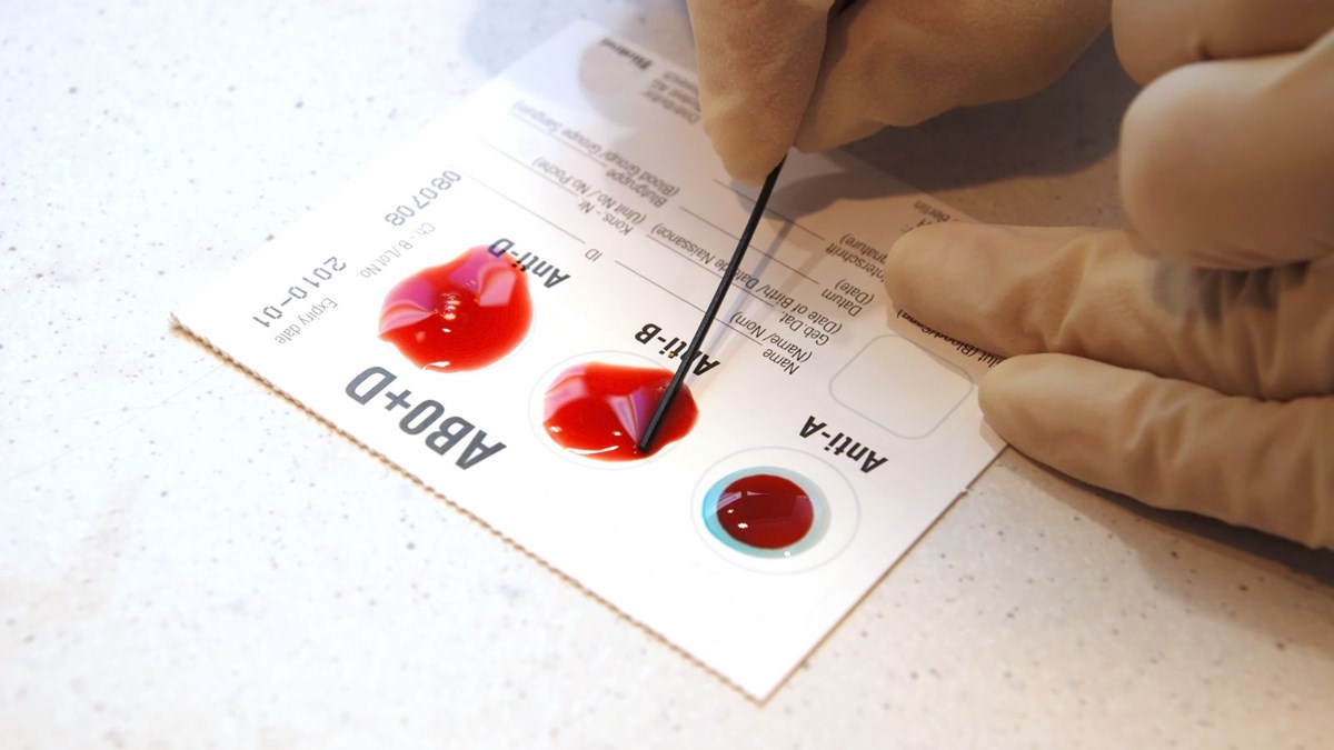 kan gruplari ile covid 19 tan agir hastalanma ya da olum riski arasinda hicbir baglanti yok saglik haberleri ntv