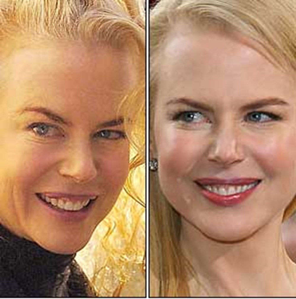 Николь кидман без макияжа фото Николь кидман без макияжа фото