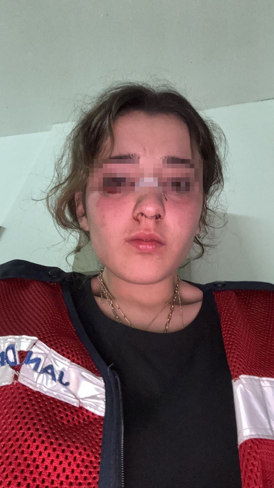Bayram tatilinde Hilal'e dehşeti yaşattı: Motosiklet kaskıyla saldırdı, kafa attı - 2