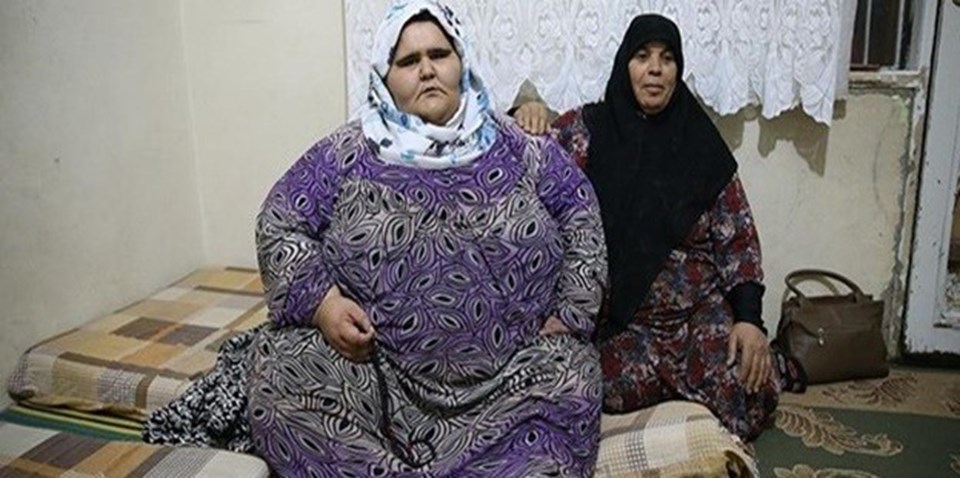 350 kilo olan Halepli kız, çareyi Türkiye'de arıyor - 1