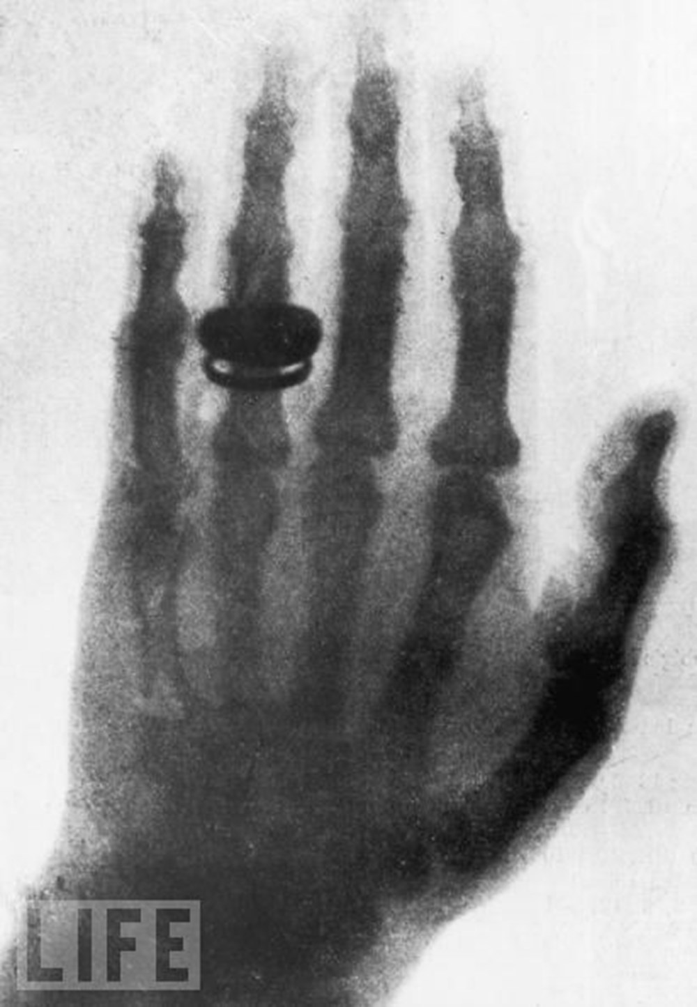 Hayatın röntgeni NTV Hayatın röntgeni NTV