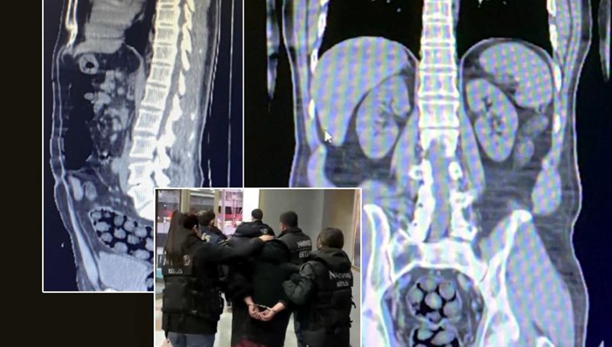 Midesinde uyuşturucu taşıyan İranlı kuryeler yakalandı! Midesinde uyuşturucu taşıyan İranlı kuryeler yakalandı!