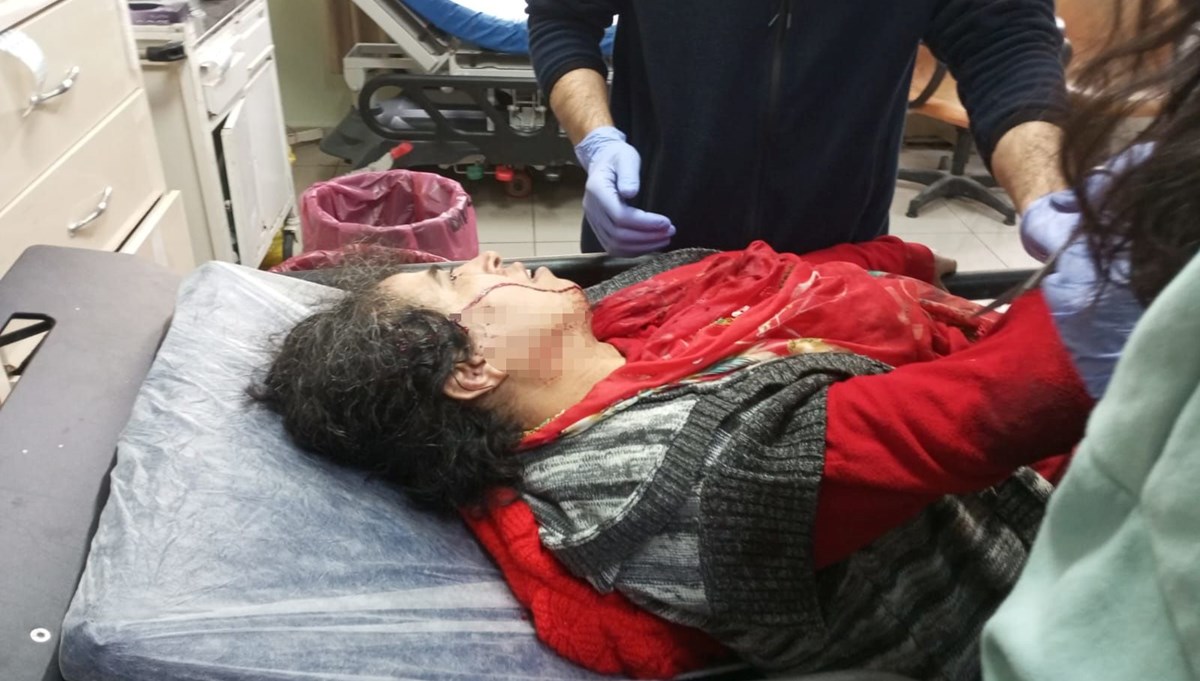 Yasaklı ırk köpek saldırdı Yasaklı ırk köpek saldırdı