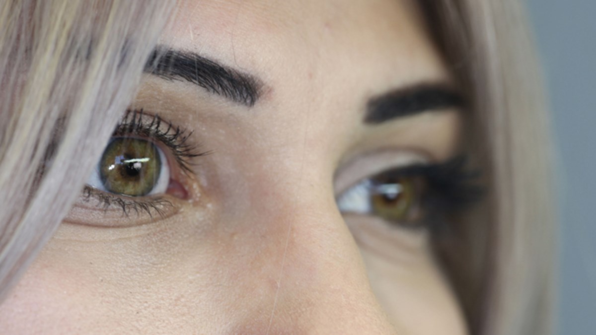 Goz Protezinde Bilinmesi Gereken 8 Sey Saglik Haberleri Ntv