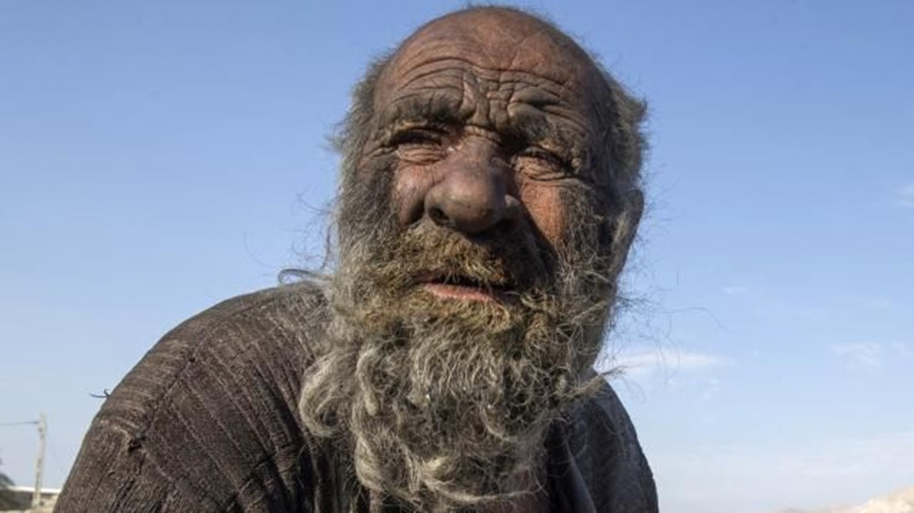 Dünyanın en kirli adamı 94 yaşında öldü - 4