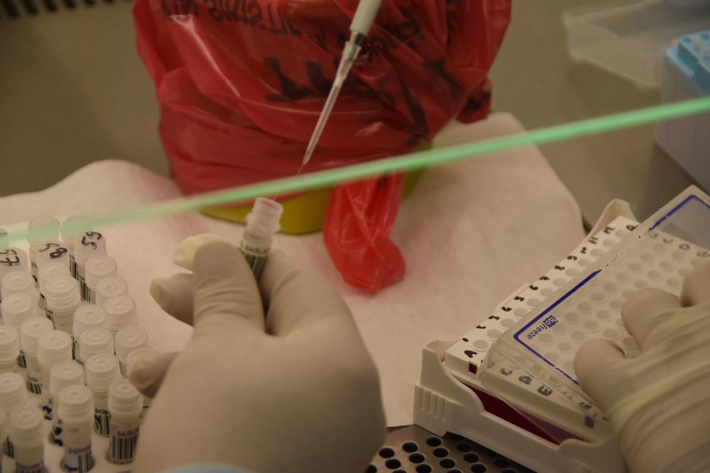 Mutated corona virus cases are detected in 40 minutes - 24