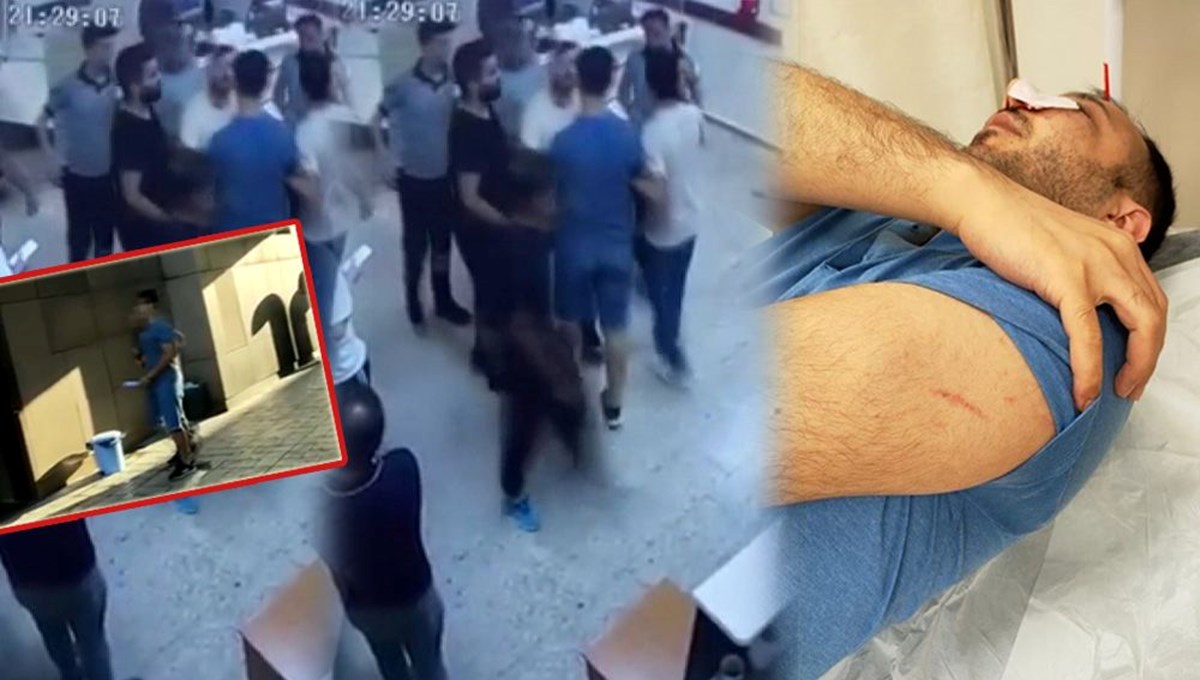 Elmacık kemikleri kırıldı