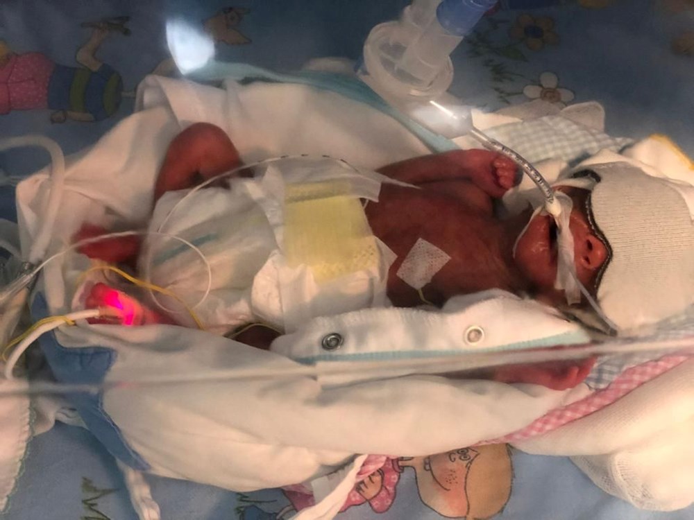 648 gram doğdu, 3 ay yoğun bakımda kaldı: Umut bebek hayata tutunmayı başardı - 5