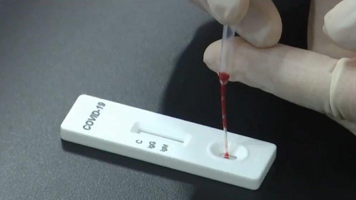 evde antikor testi uyarisi gercegi yansitmayabilir saglik haberleri ntv