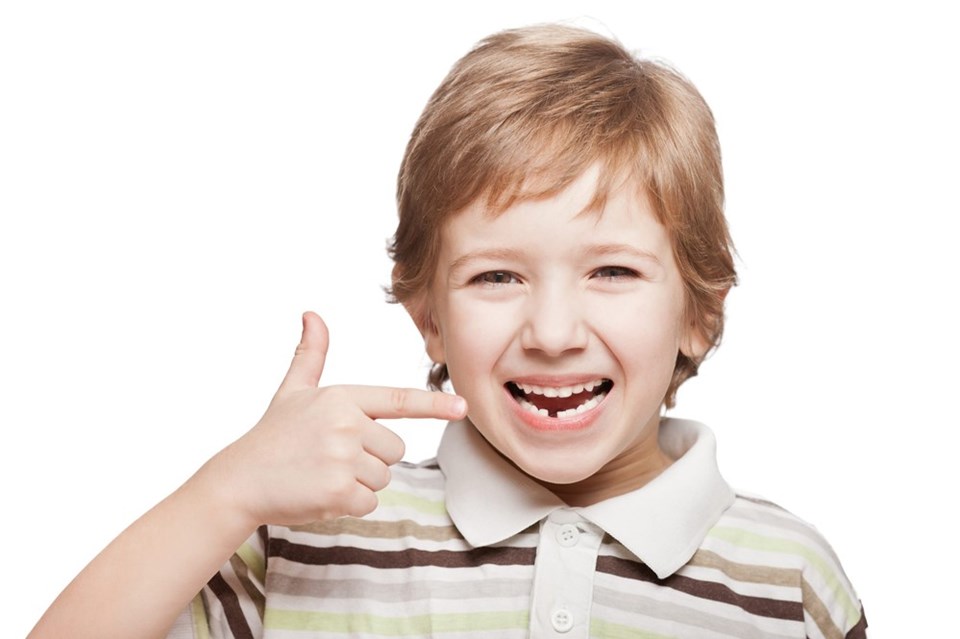 Çarpık dişlere şeffaf plak müdahalesi - 1