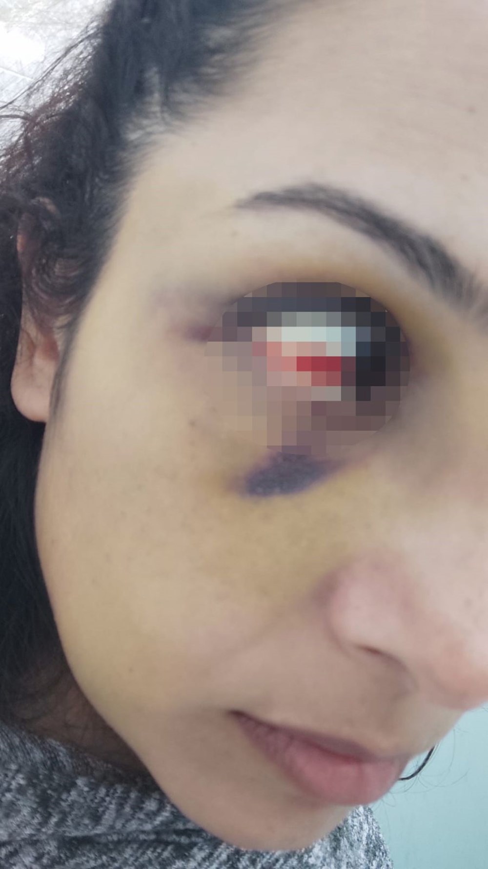 Burcu öğretmenin yardım çığlığı: "Beni bu adamdan kurtarın" - 3