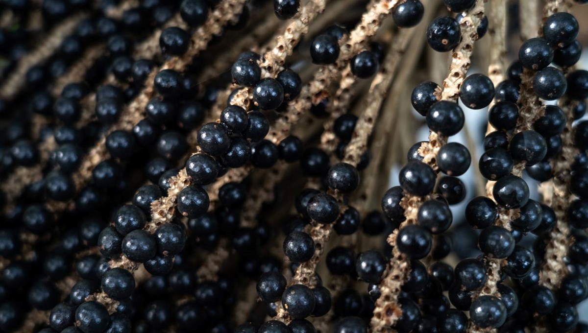 Böbrek sağlığı: Büyük fark yaratan 5 basit yaşam tarzı değişikliği