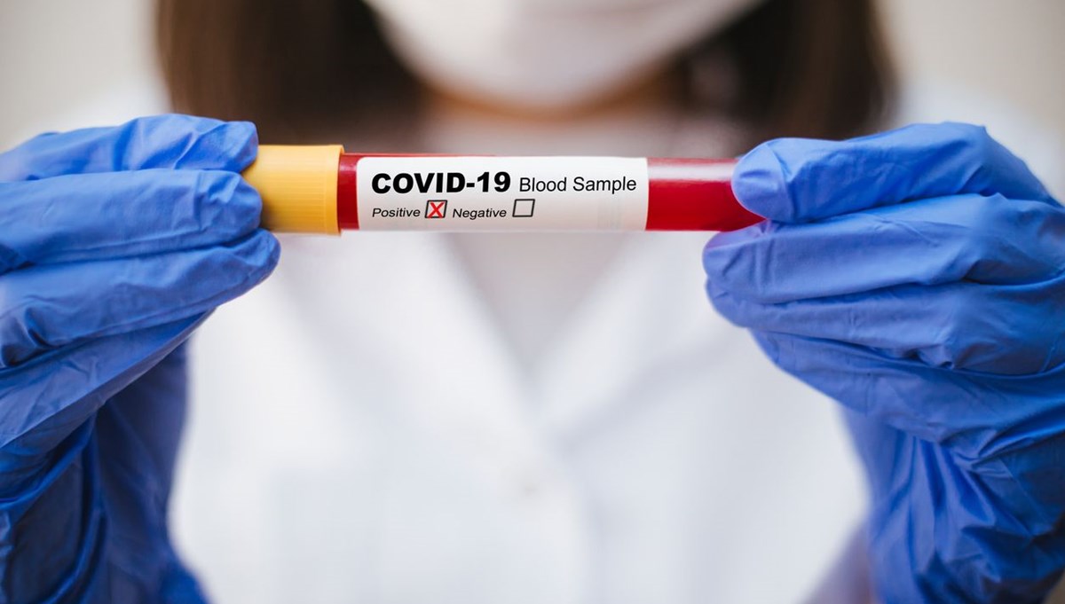 Lancet: Covid geçirenler yeniden enfekte olabilir Lancet: Covid geçirenler yeniden enfekte olabilir