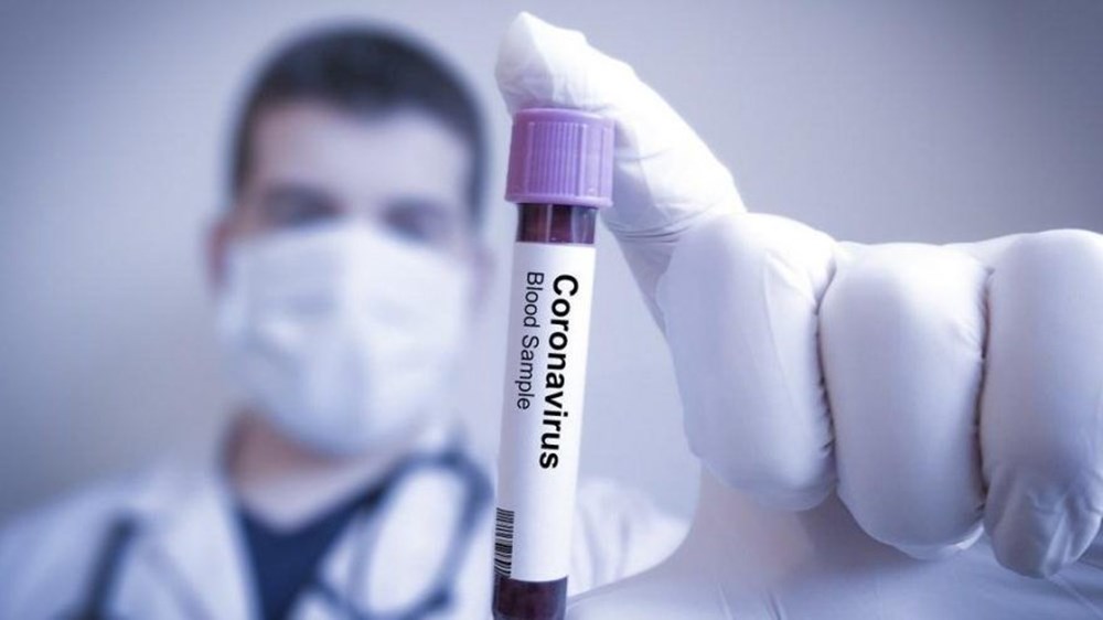 Corona virüsü dünya genelinde yayılıyor (Virüs İskandinav yarımadasına da sıçradı) - 12