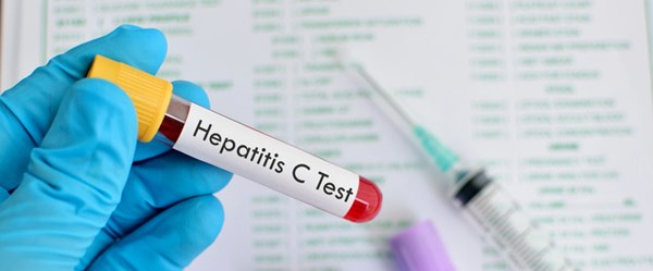 “Herkes mutlaka Hepatit C testi yaptırmalı”