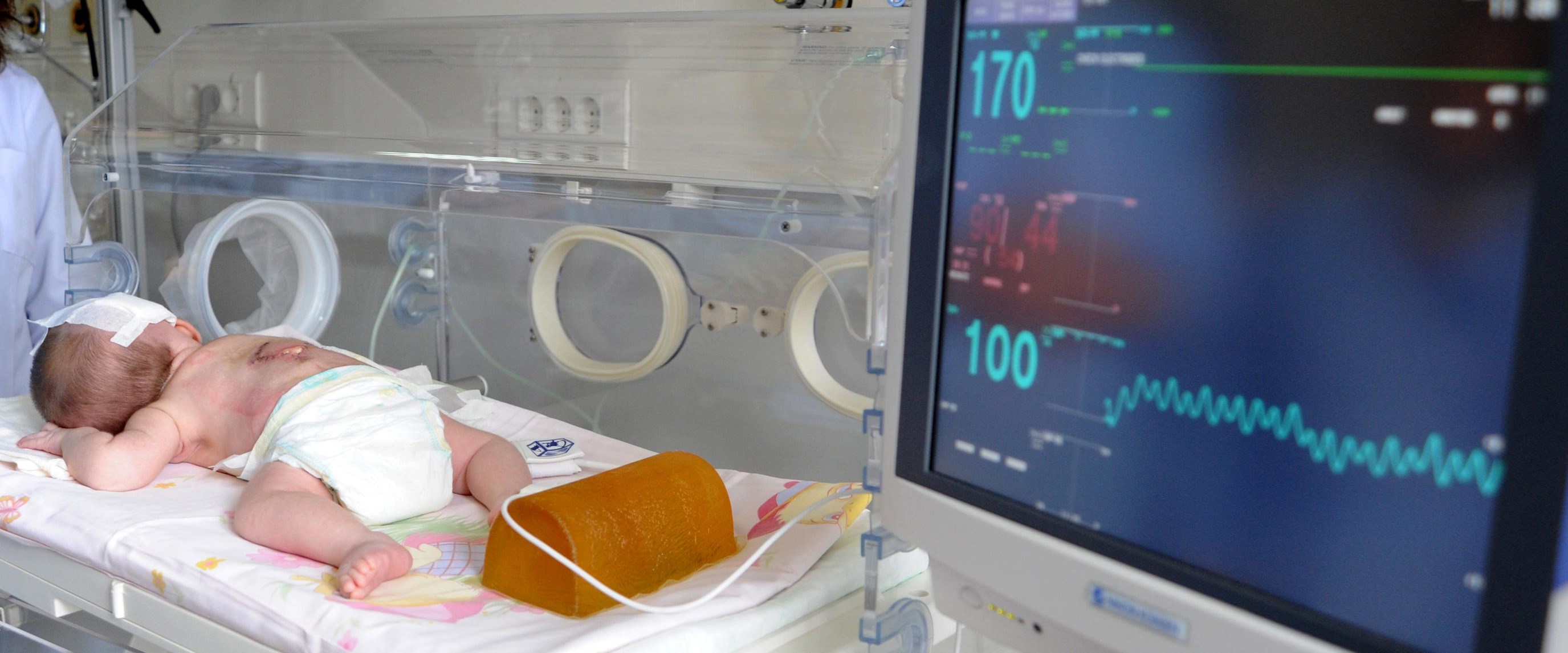 Annede Folik Asit Eksikligi Bebekte Olum Riski Olusturuyor