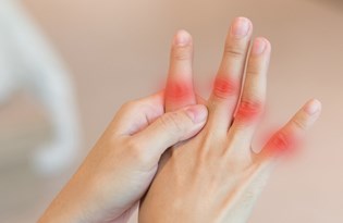 Gul Hastaligi Rozasea Nedir Gul Hastaligi Belirtileri Nelerdir Nasil Tedavi Edilir Saglik Haberleri Ntv