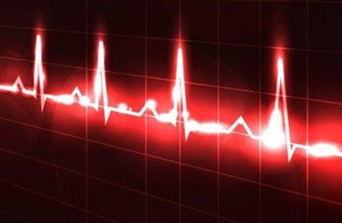 Kalp Yorgunlugunu Onlemek Icin Vucudunuzu Yorun Saglik Haberleri Ntv