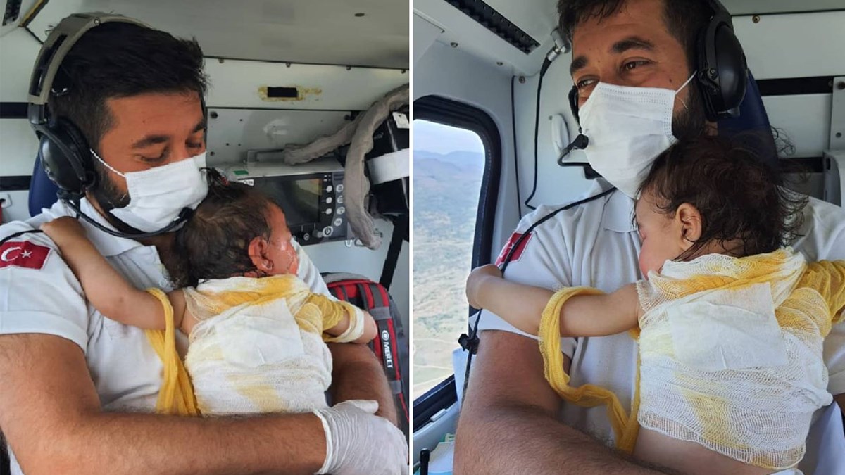 sicak suyla yanan beril bebek ambulans helikopterle eskisehir e sevk edildi son dakika turkiye haberleri ntv haber