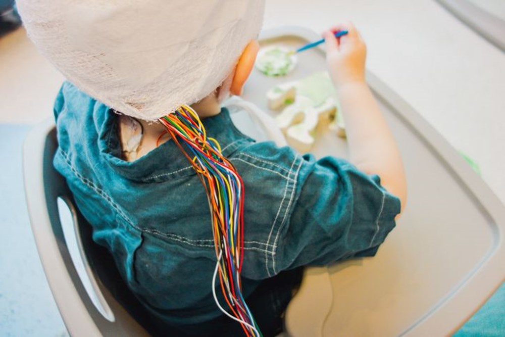 Tıp tarihinde bir ilk! Epilepsi hastası çocuk kafasına yerleştirilen cihazla iyileşti 1 Tıp tarihinde bir ilk! Epilepsi hastası çocuk kafasına yerleştirilen cihazla iyileşti - 2