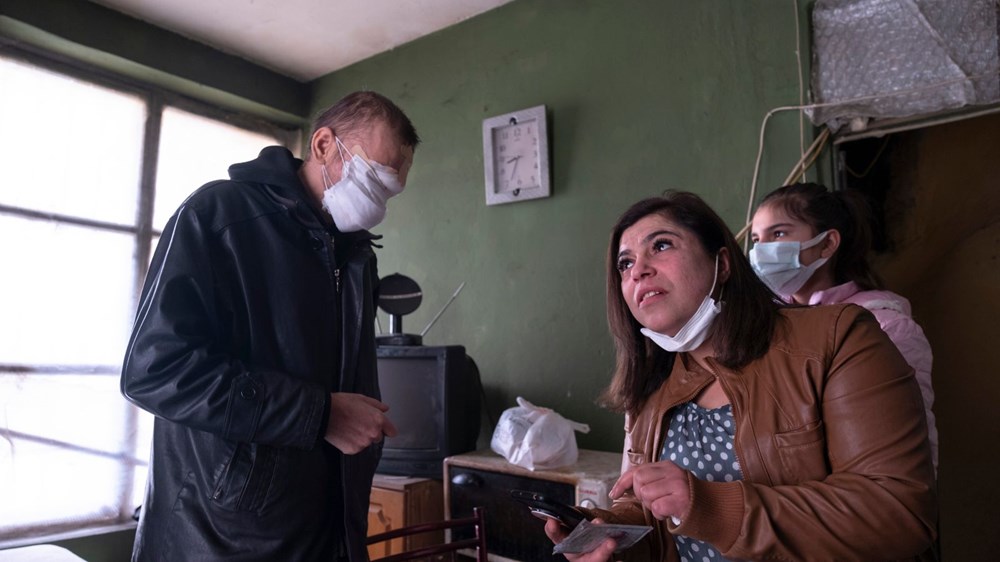 Cilt kanserinden yüzünü kaybeden baba: Kızımı öpmeyi çok özledim - 2