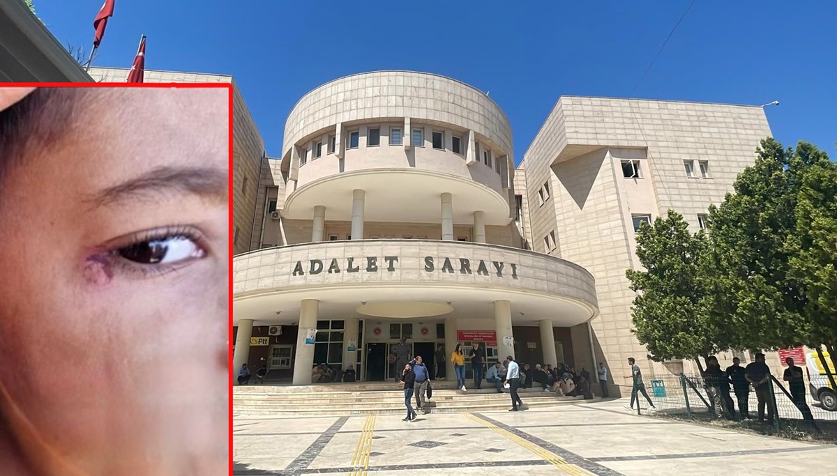 Öğrencinin yüzünde sigara söndürdü!