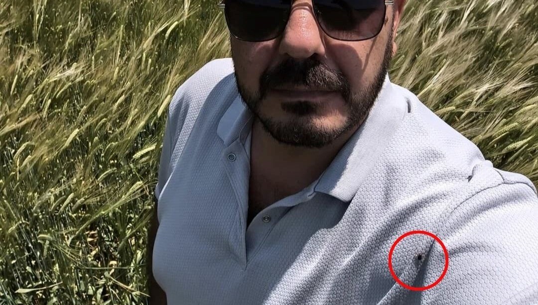 Çektiği fotoğrafta keneyi fark etti