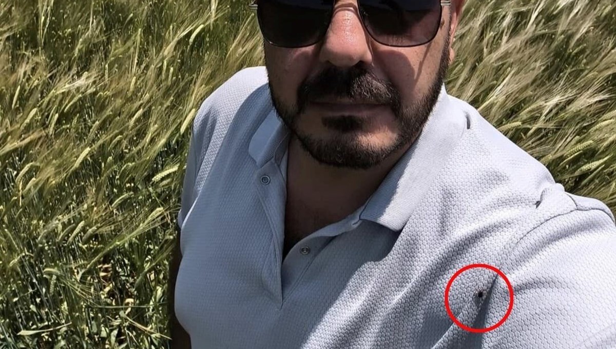 Çektiği fotoğrafta keneyi fark etti