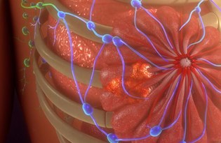 meme kistleri kansere donusmez