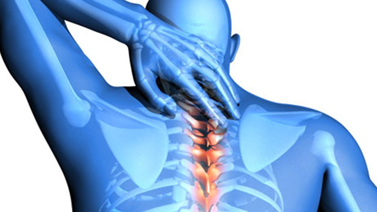 Skolyoz Tedavisinde Yuz Gulduren 3 Yontem Saglik Haberleri Ntv