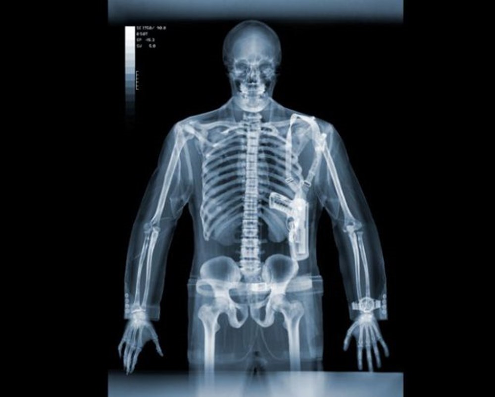 Рентген что это. Рентген Nick Veasey. Ник визи рентген. Ник визи. X-ray men. Рентгеновский снимок.