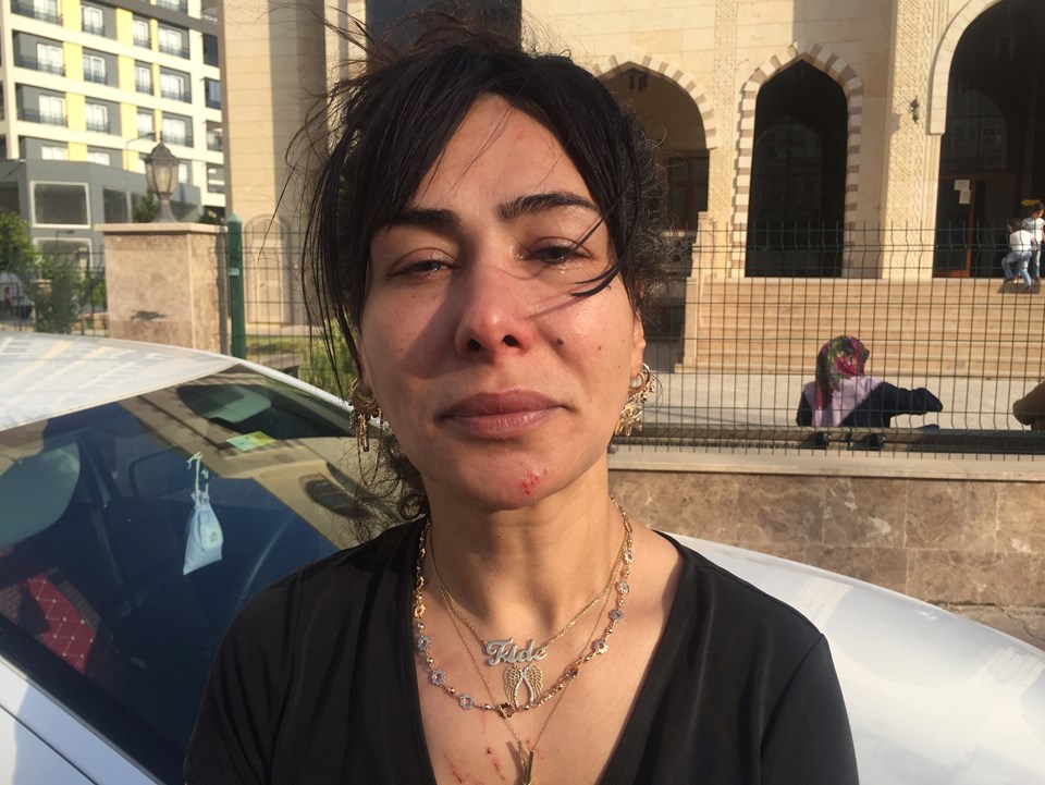 Adana'da dayak, işkence, taciz: Ben öldükten sonra hakkımı savunmayın - 3