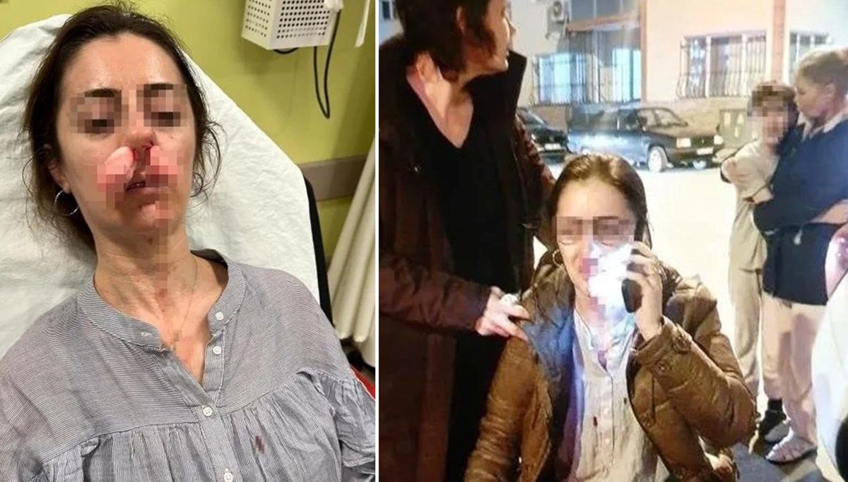 Eşinin sevgilisi sandı, arabanın kapısıyla dövdü Eşinin sevgilisi sandı, arabanın kapısıyla dövdü