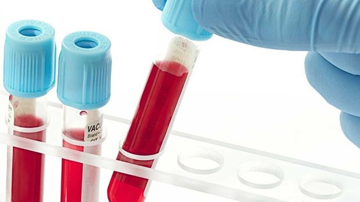 kan grubuna bakilarak babalik saptanamaz saglik haberleri ntv